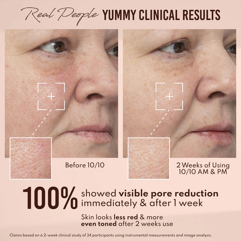 Yummy Skin 10/10 Barrier Boost Hyaluronic Acid + Ectoin Plumping Serum