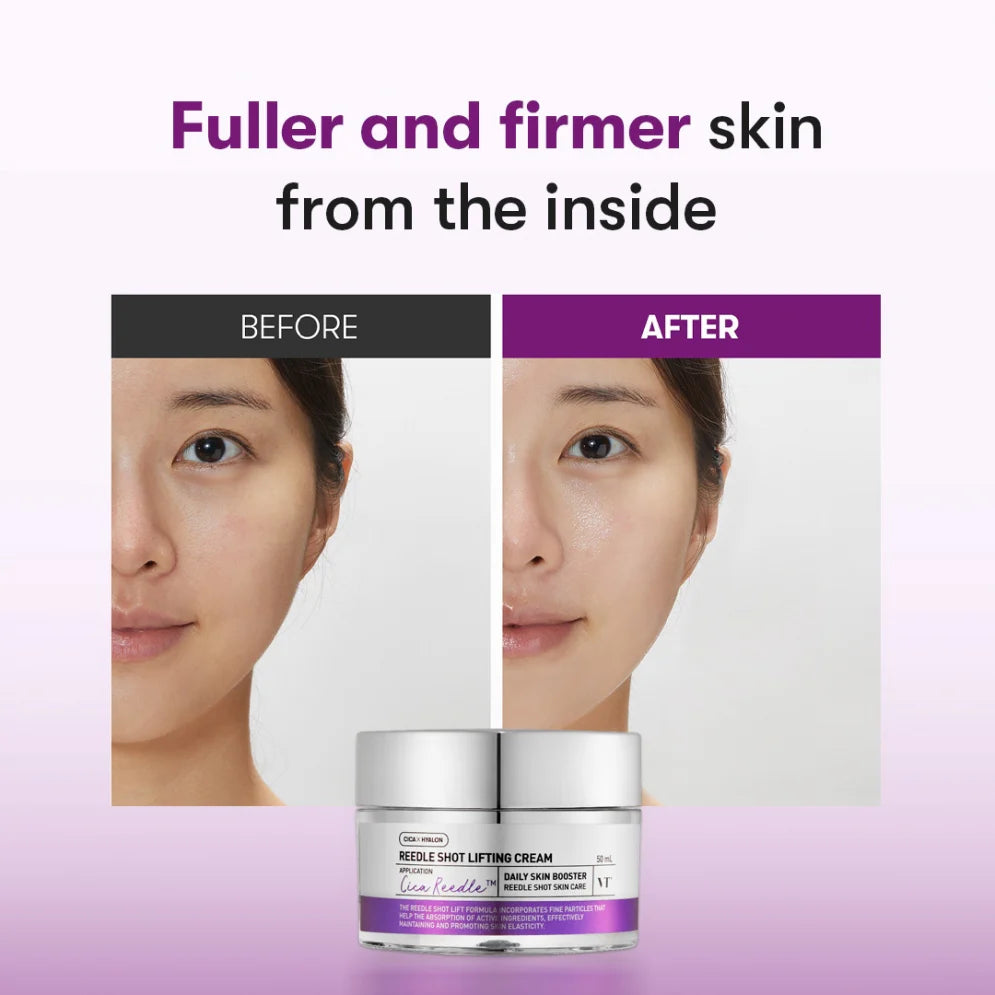 Reedle Shot Lifting Cream