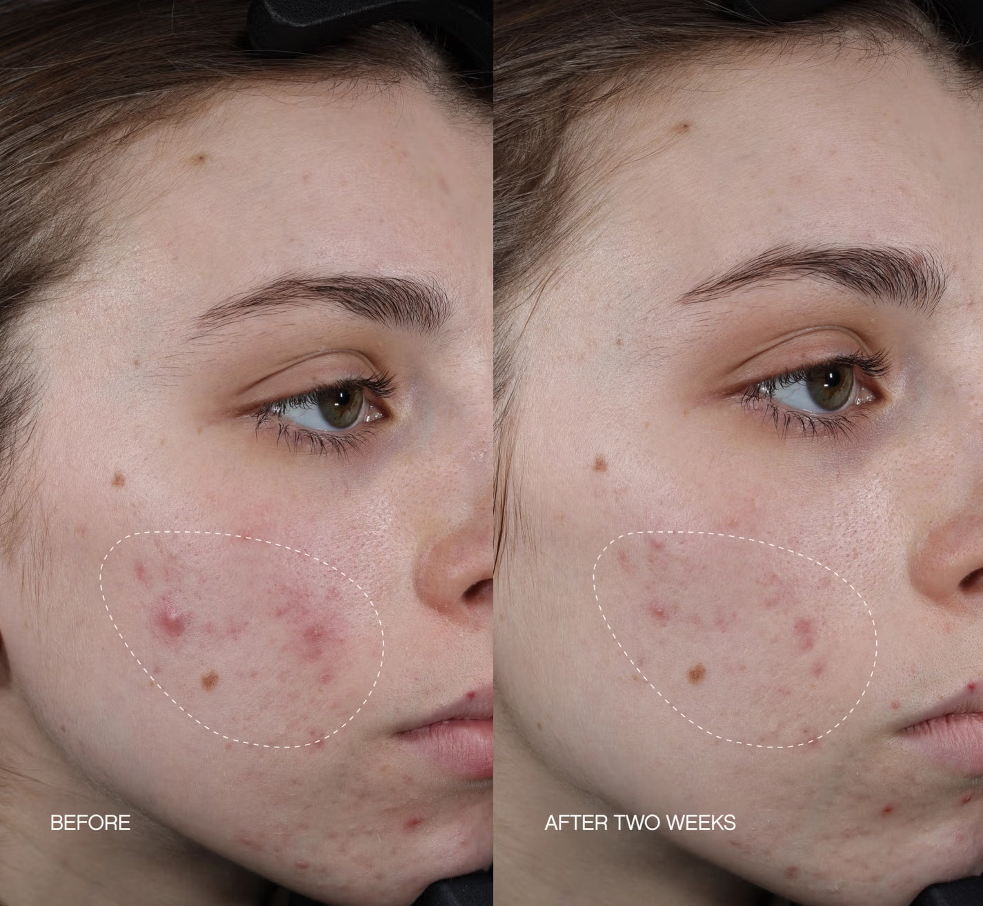 Faded Brightening + Clearing Serum