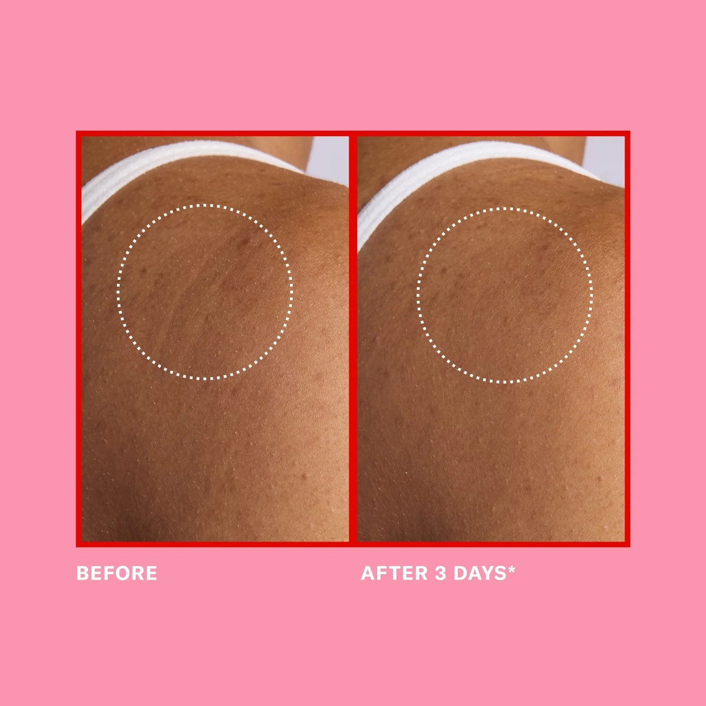 Pro-Retinol Face + Body Set