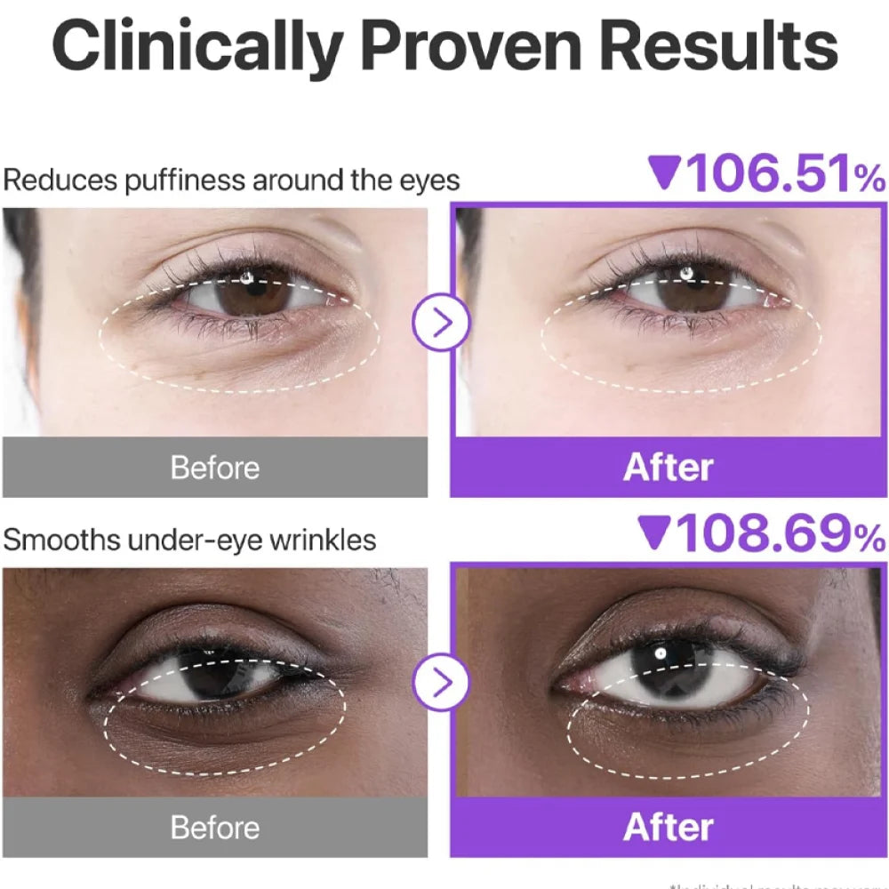 NAD+ Collagen Hydrogel Under Eye Patches