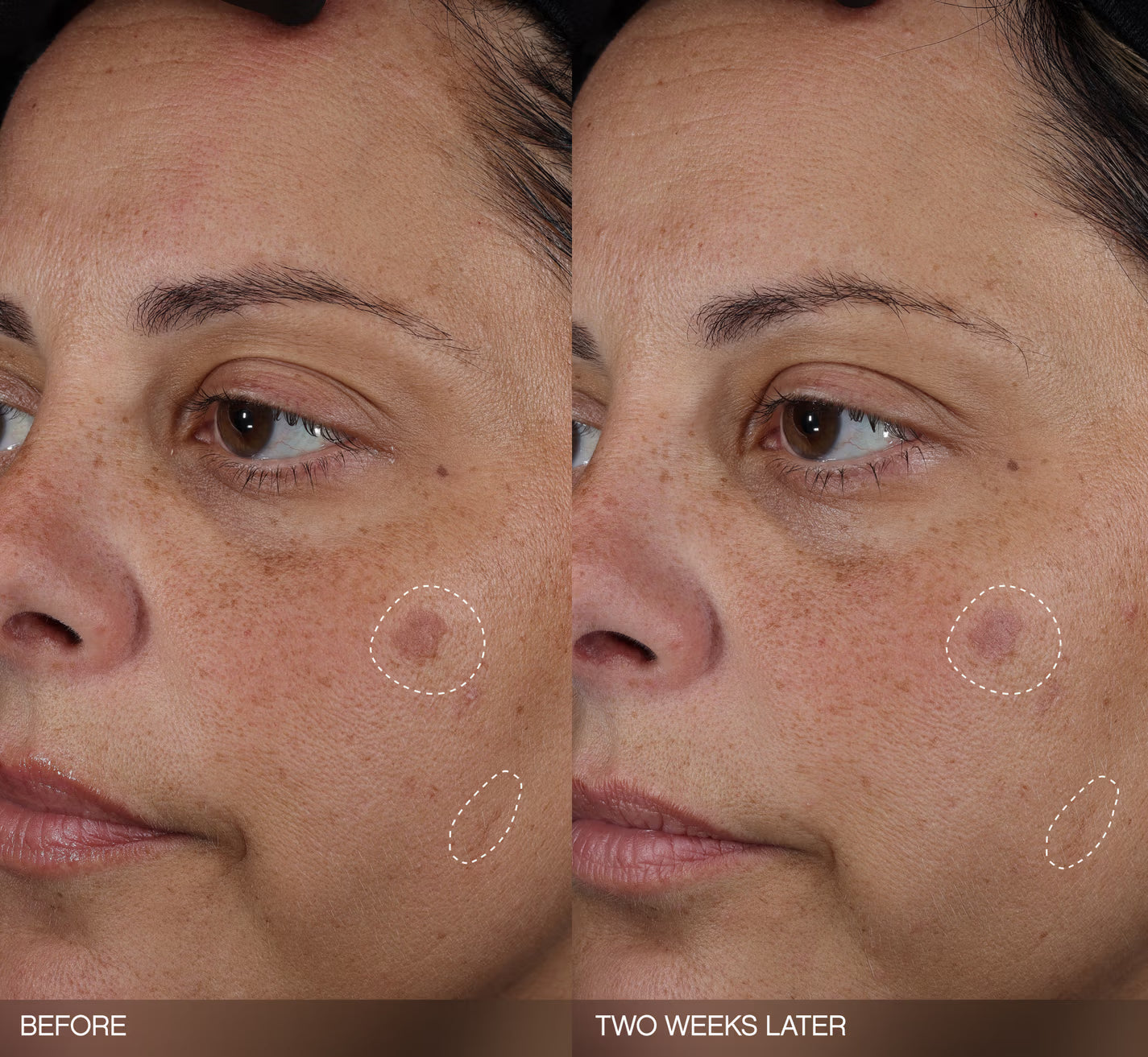 Faded Dark Spot Patches