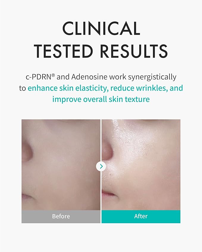 Rejuran TurnOver Mask