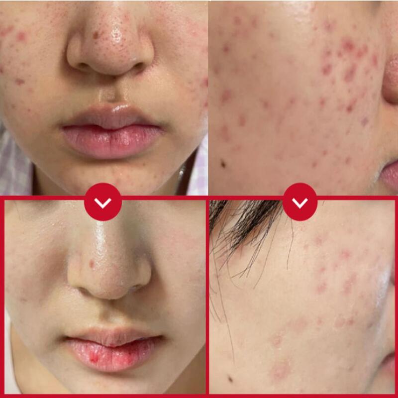 Cica Exo Soothing Cream 50ml ( Vegan)