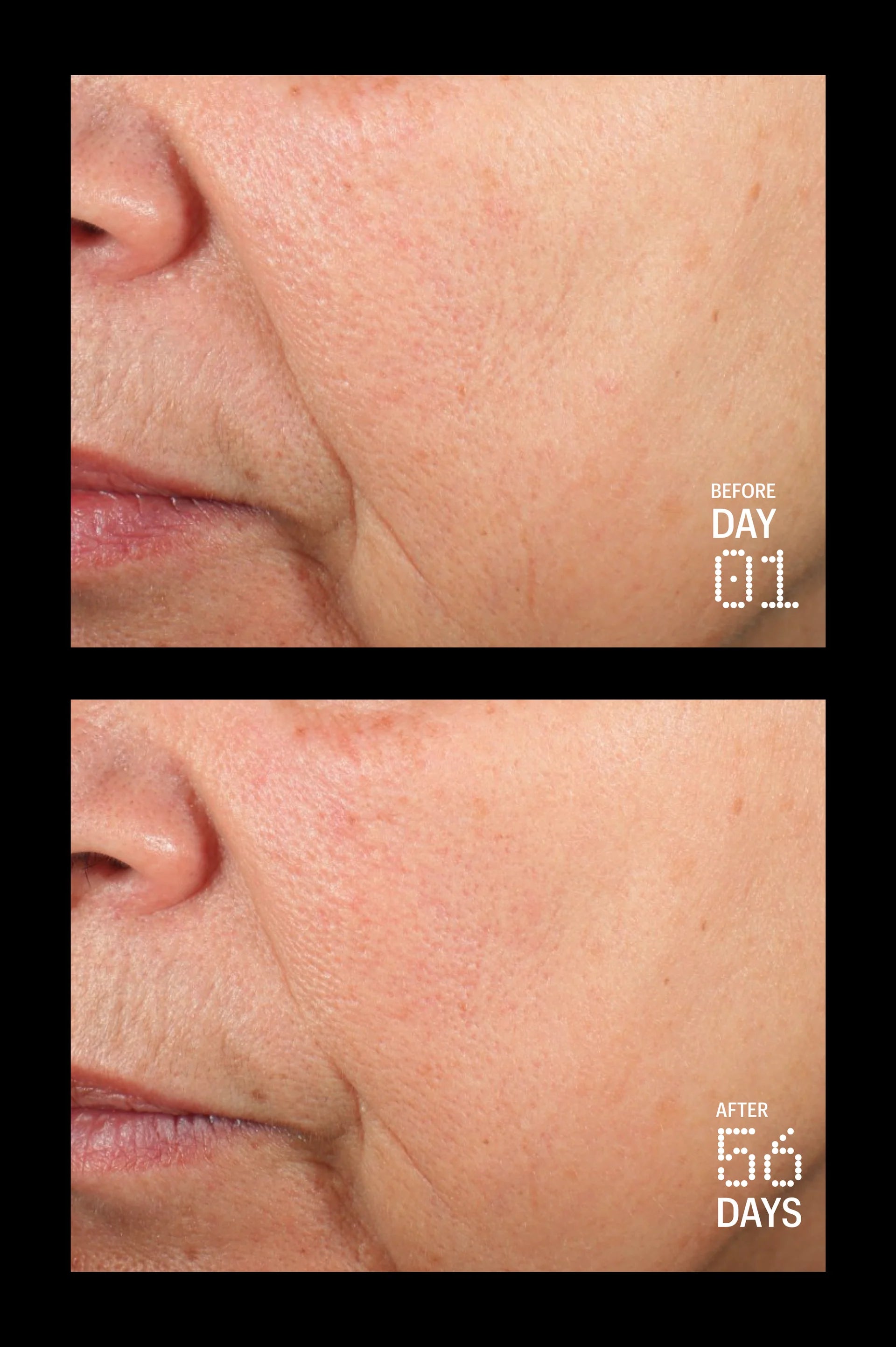 Peptides & Antioxidants Advanced Firming Daily Treatment
