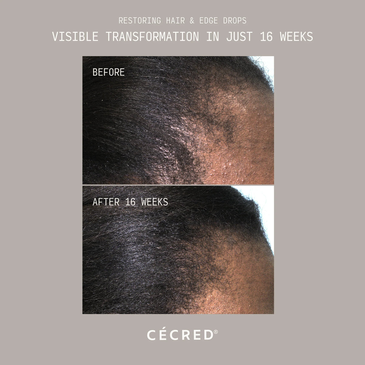 Cecred Restoring Hair & Edge Drops