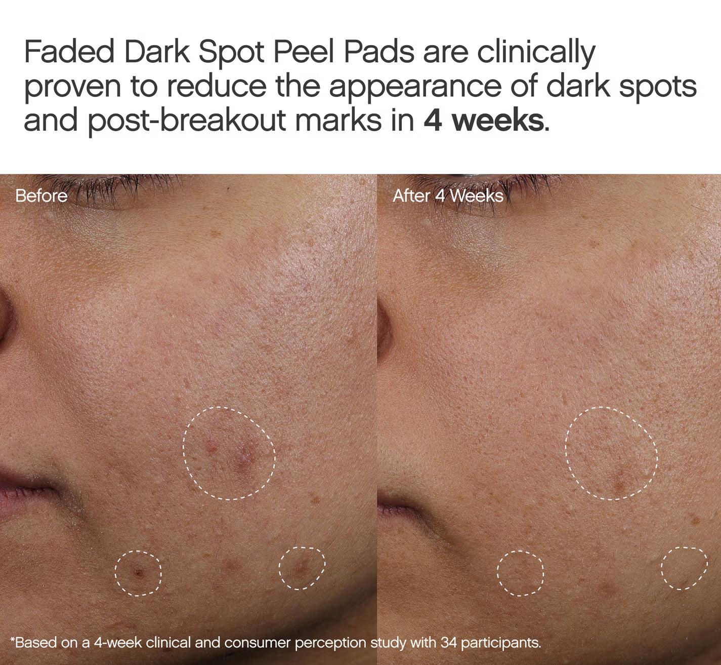 Faded Dark Spot Patches