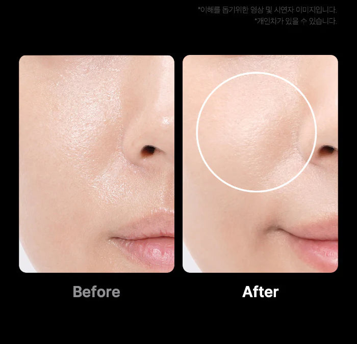 Age-R Booster Pro 6-in-1 Total Care LED Therapy