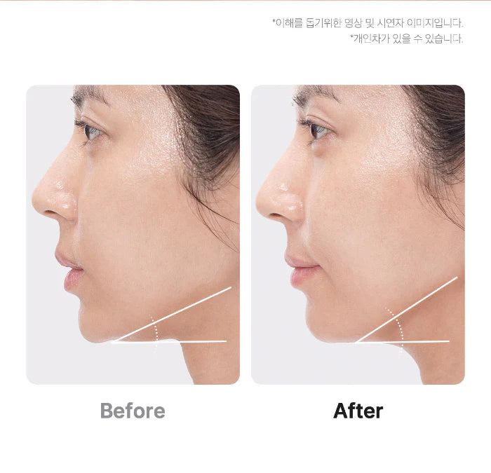 Age-R Booster Pro 6-in-1 Total Care LED Therapy