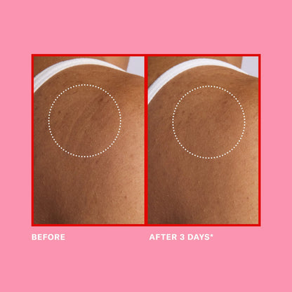 Pro-Retinol Face + Body Set