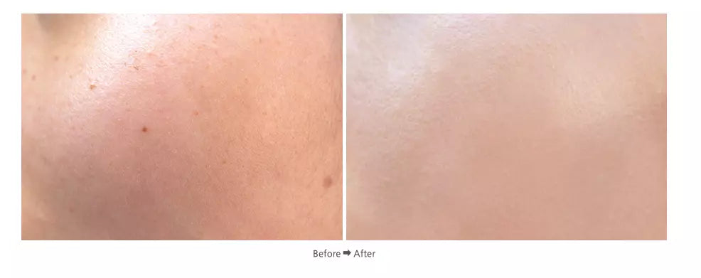 Miracle Cushion