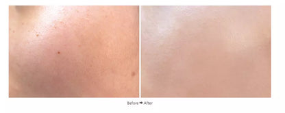 Miracle Cushion